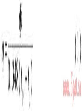 公共建筑廚房通風(fēng)系統(tǒng)設(shè)計